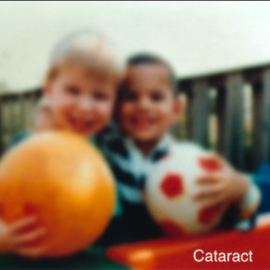 Vision with cataracts