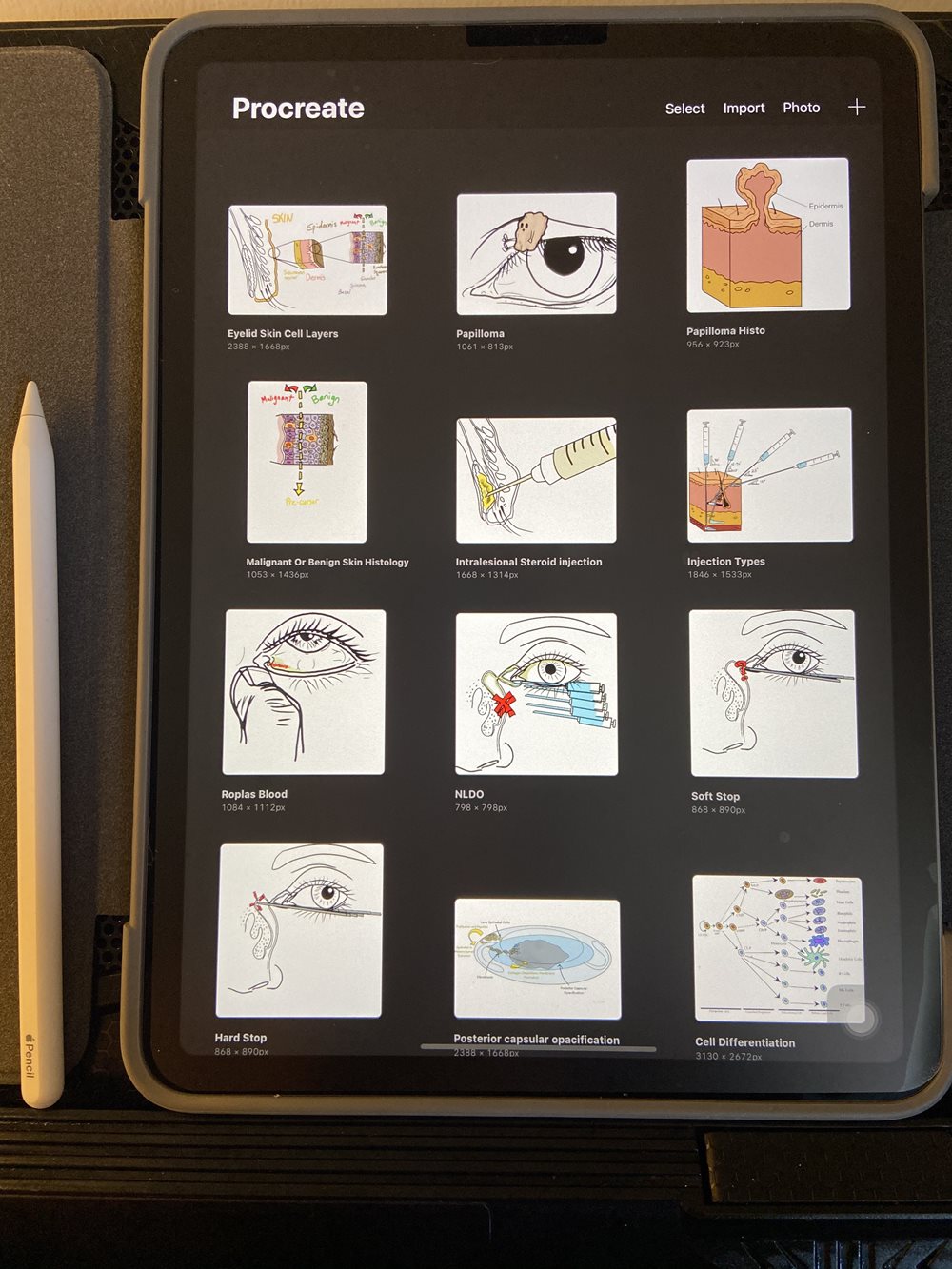 Dr. Lim's optometry illustrations